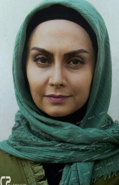 عکس مریم خدارحمی قبل از عمل زیبایی