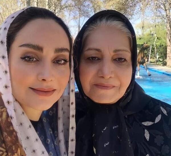عکس مریم خدارحمی قبل از عمل زیبایی