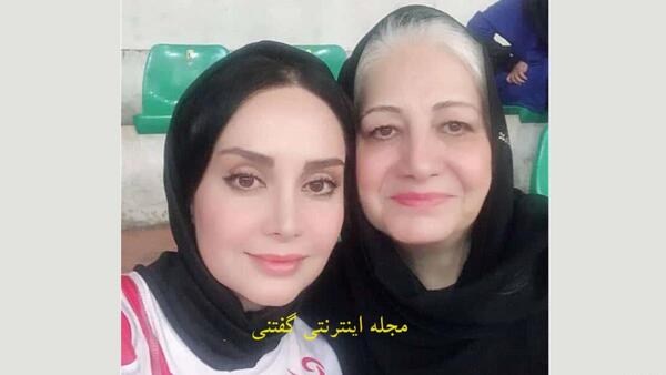 عکس مریم خدارحمی قبل از عمل زیبایی