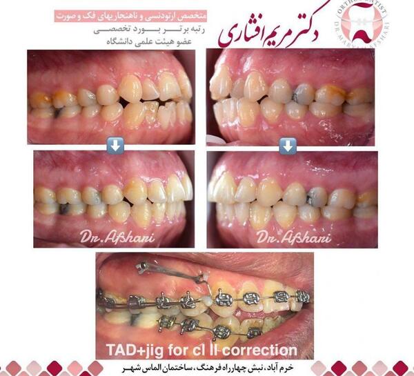 عکس مریم افشاری