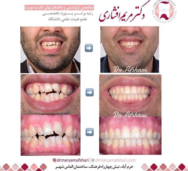 عکس مریم افشاری