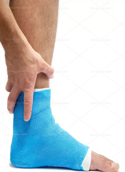 عکس فیک از پای شکسته
