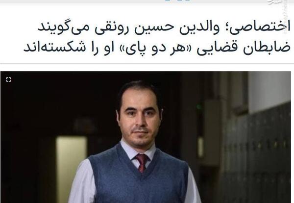عکس فیک از پای شکسته