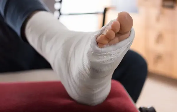 عکس فیک از پای شکسته