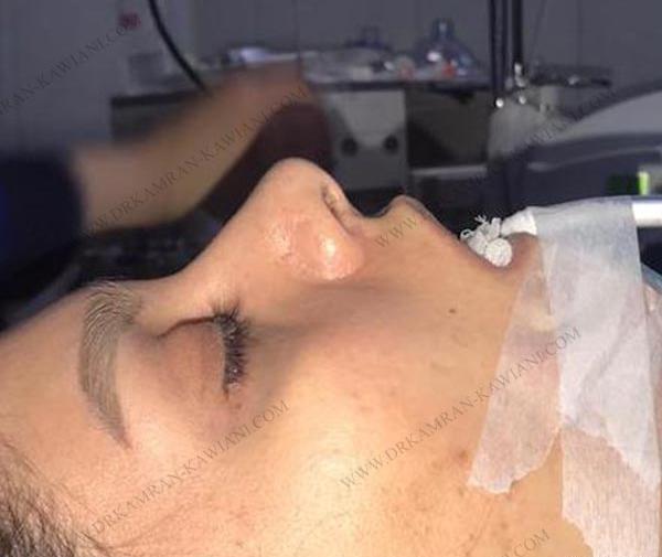 عکس فیک بیمارستان اتاق عمل