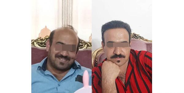 عکس حسین رفیعی قبل از کاشت مو
