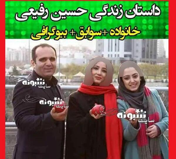 عکس حسین رفیعی قبل از کاشت مو