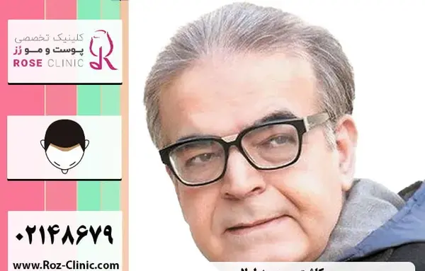 عکس حسین رفیعی قبل از کاشت مو