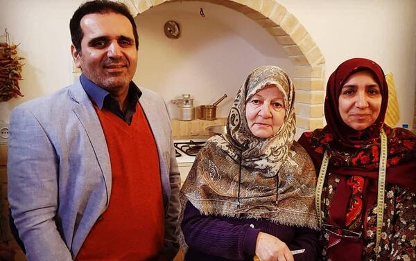 عکس حسین رفیعی قبل از کاشت مو