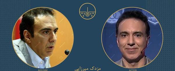 عکس حسین رفیعی قبل از کاشت مو