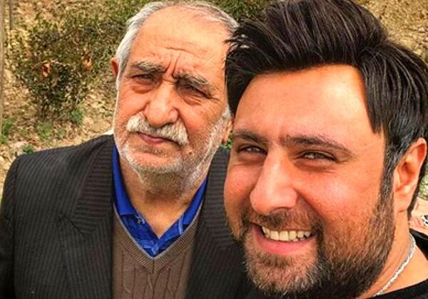عکس محمد علیزاده قبل از کاشت مو
