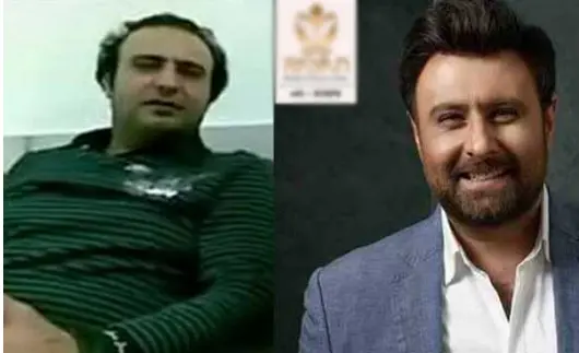 عکس محمد علیزاده قبل از کاشت مو