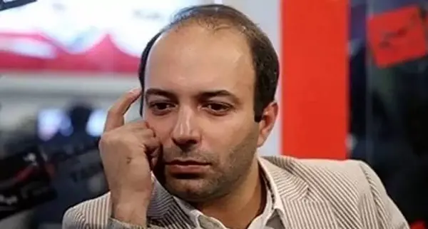 عکس محمد علیزاده قبل از کاشت مو