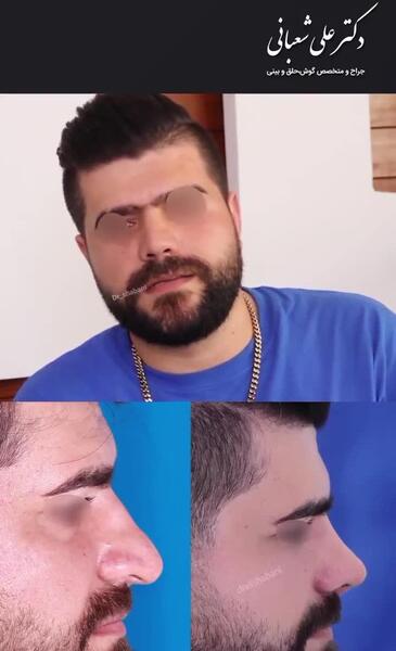 عکس محمد علی شعبانی
