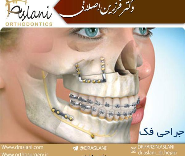 عکس قبل و بعد ارتودنسی نی نی سایت