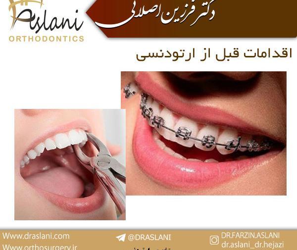 عکس قبل و بعد ارتودنسی دندان