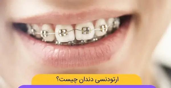 عکس قبل و بعد ارتودنسی با کشیدن دندان