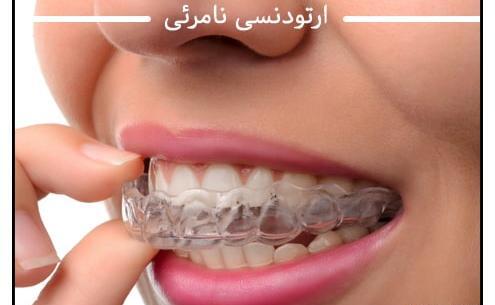 عکس قبل و بعد ارتودنسی نامرئی