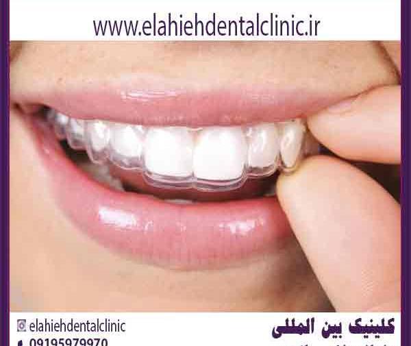 عکس قبل و بعد ارتودنسی نامرئی