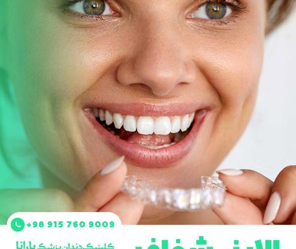 عکس قبل و بعد ارتودنسی نامرئی