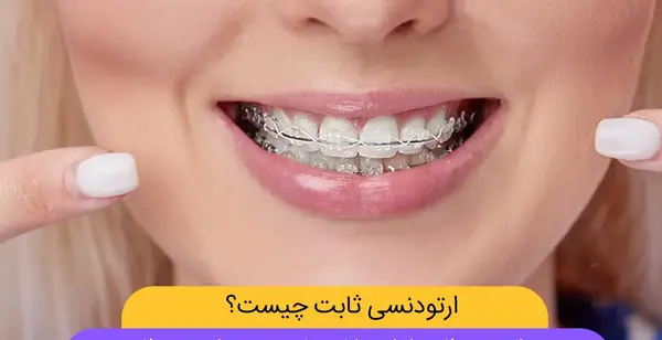 عکس قبل و بعد از ارتودنسی