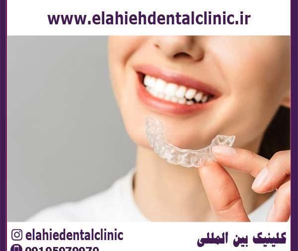 عکس قبل و بعد از ارتودنسی