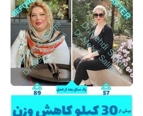 عکس قبل و بعد لاغری نی نی سایت