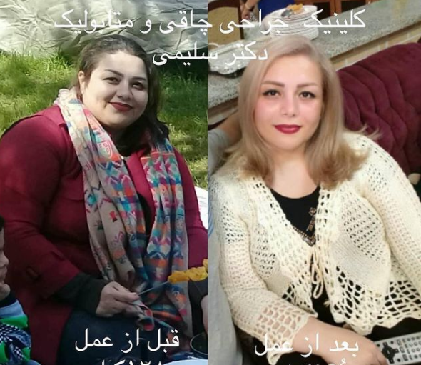 عکس قبل و بعد لاغری نی نی سایت