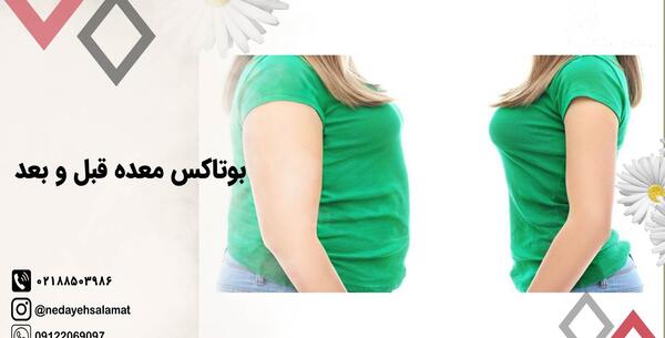عکس قبل و بعد لاغری نی نی سایت