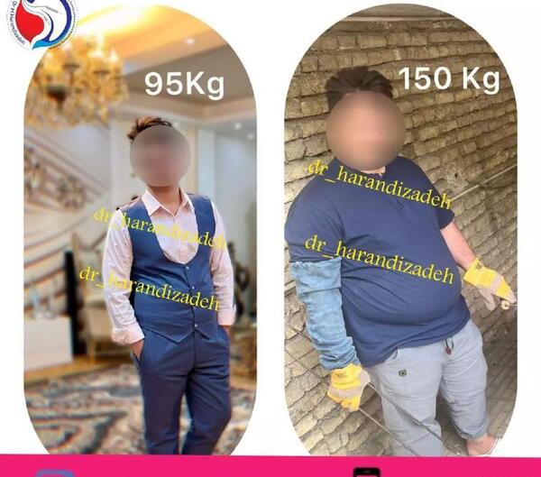 عکس قبل و بعد لاغری نی نی سایت