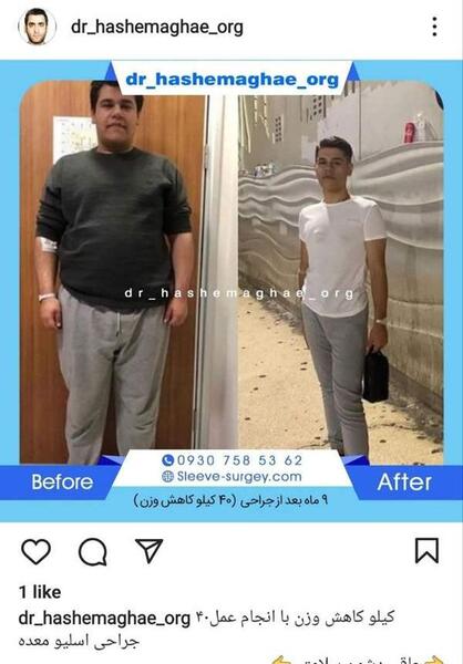 عکس قبل و بعد لاغری نی نی سایت