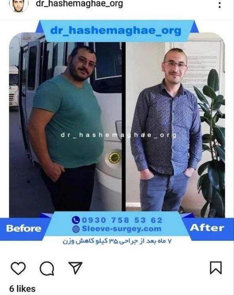عکس قبل و بعد لاغری نی نی سایت