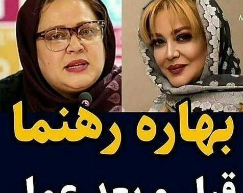 عکس قبل و بعد لاغری ایرانی