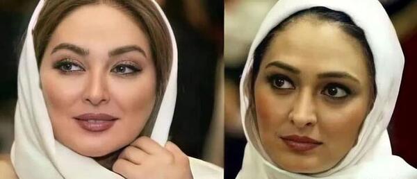 عکس قبل و بعد لاغری ایرانی