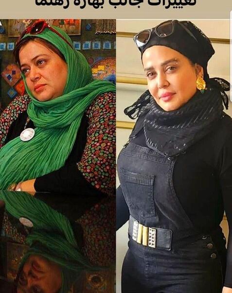 عکس قبل و بعد لاغری ایرانی