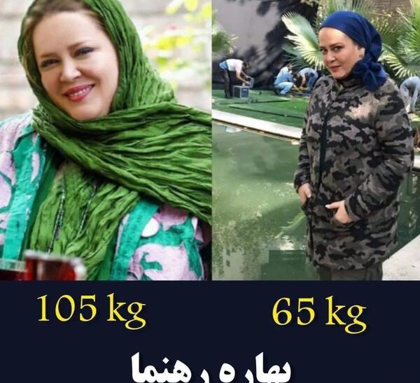 عکس قبل و بعد لاغری ایرانی