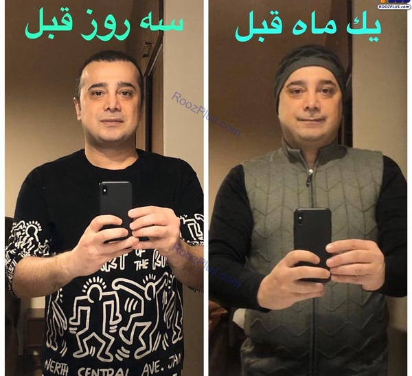 عکس قبل و بعد لاغری ایرانی