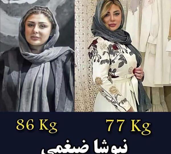 عکس قبل و بعد لاغری صورت