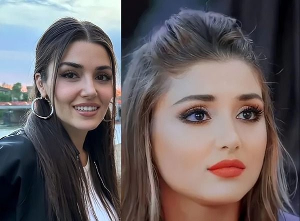 عکس قبل و بعد لاغری هانده ارچل