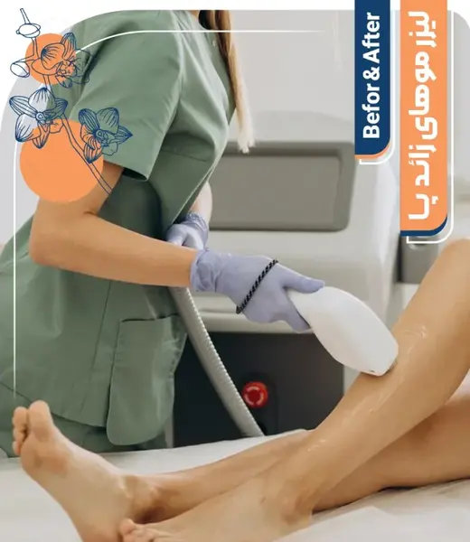 عکس قبل و بعد از لیزر پوست بدن