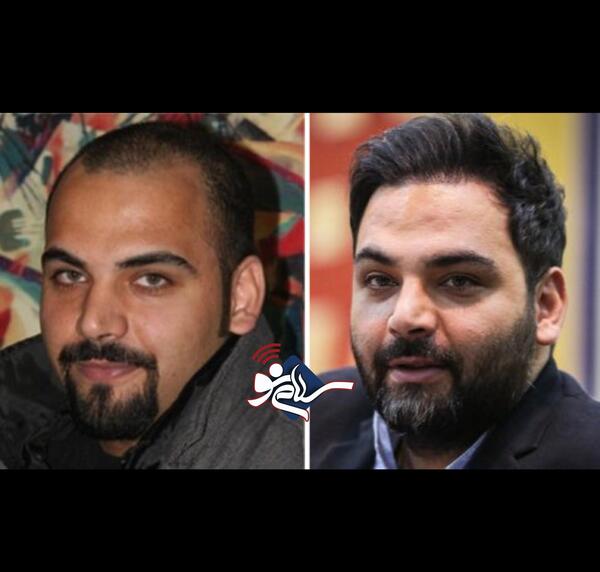 عکس های قبل از عمل زیبایی احسان علیخانی