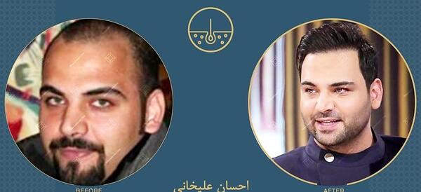 عکس های قبل از عمل زیبایی احسان علیخانی