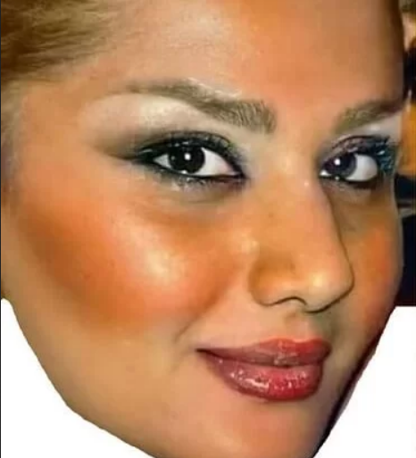 عکس قبل از عمل جراحی دنیا جهانبخت