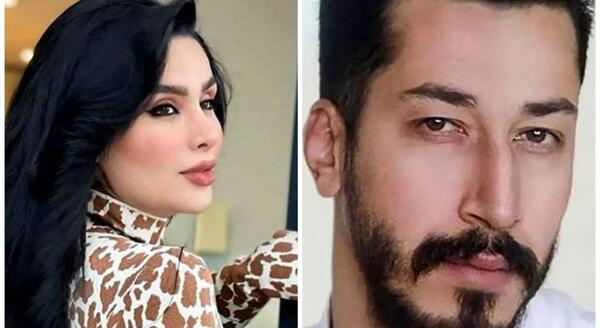 عکس قبل از عمل جراحی دنیا جهانبخت