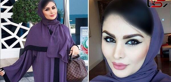 عکس قبل از عمل جراحی دنیا جهانبخت