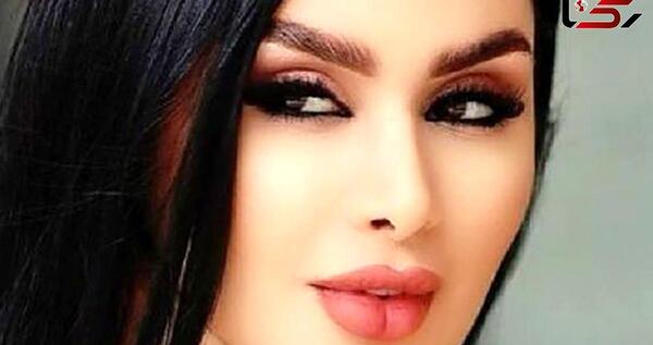 عکس قبل از عمل جراحی دنیا جهانبخت