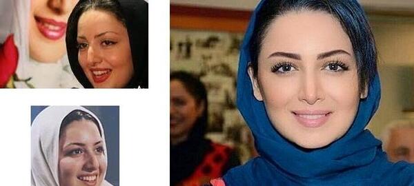 عکس قبل از عمل جراحی دنیا جهانبخت