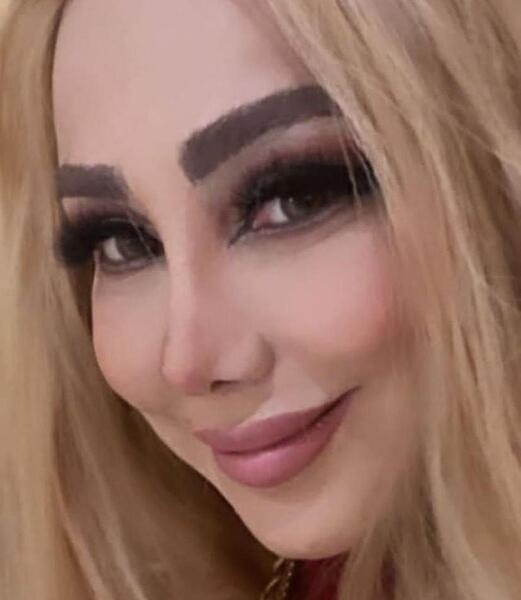 عکس قبل از عمل جراحی دنیا جهانبخت