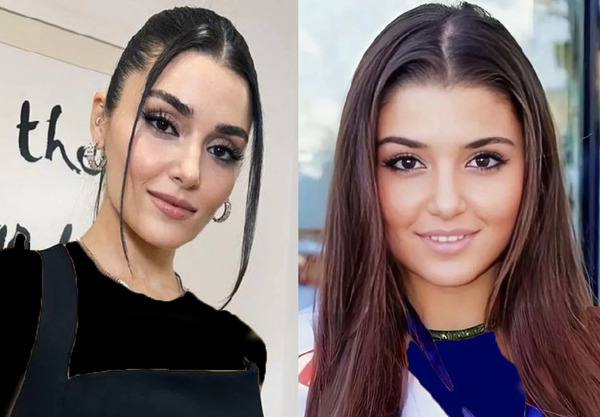 عکس های قبل عمل هانده ارچل
