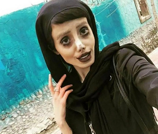 عکس سحر تبر قبل از عمل در اینستا